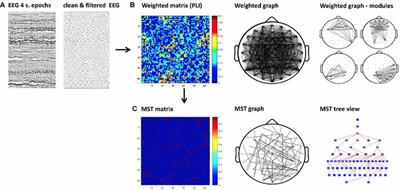 EEG Resting State Functional Connectivity in Adult Dyslexics Using Phase Lag Index and Graph Analysis
